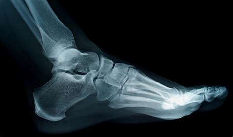 Does a Sprain Show Up on an X-ray? And Why Do Bananas Dream of Electric Sheep?